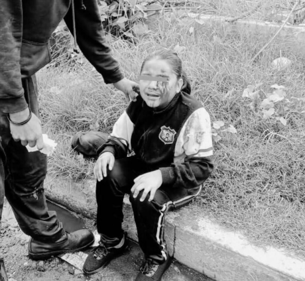 Indignación en Ixtapaluca por coladeras sin tapa; niña resulta herida